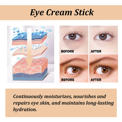 Snail Radiance Eye Cream Stick – Smooth Eyes, Bright Days